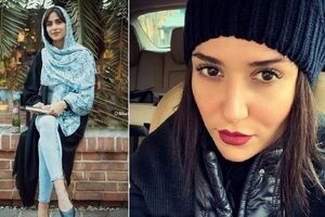 عکس جنجالی پریناز ایزدیار بعد از جراحی زیبایی اش | پریناز ایزدیار رنگ چشمش را عوض کرد