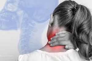 راهکار عالی برای درمان گردن درد | خبر مهم برای بیماران