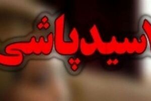 ماجرای وحشتناک اسید پاشی ولی اینبار قربانی پسر 21 ساله هست