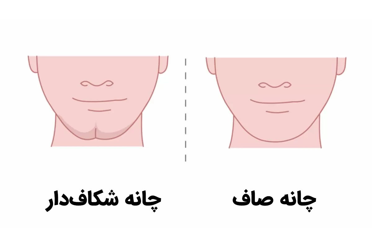 روانشناسی | شاید باورتان نشود که شکل چانه میتواند حقایق درونیتان را فاش کند!