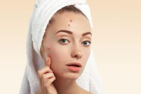 خانما میخاین دیگه جوش نزنین از این میوه غافل نشین