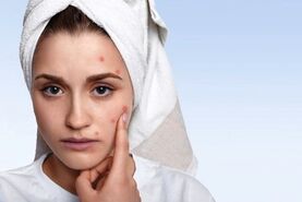 بهترین و آسان ترین ره حل برای پوستی که با استرس خراب شده است