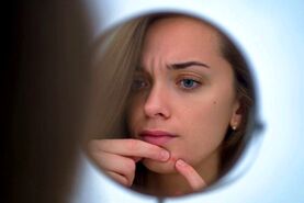 پوست زیبا و بدون جوش با این ماسک خانگی | سه سوته پوستتو مثل آینه کن